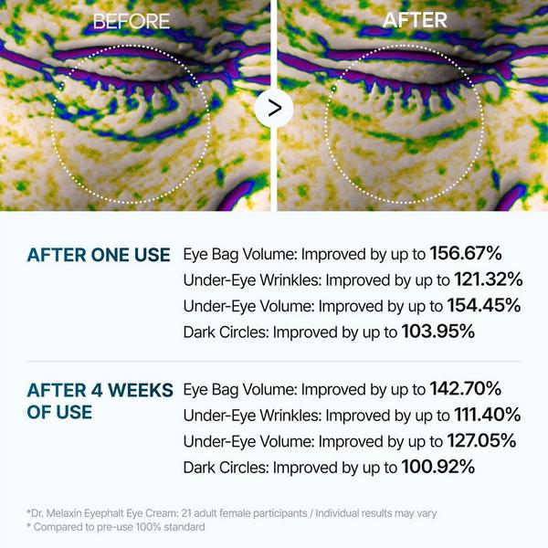 Dr. Melaxin Eyephalt Eyebag Cream #7