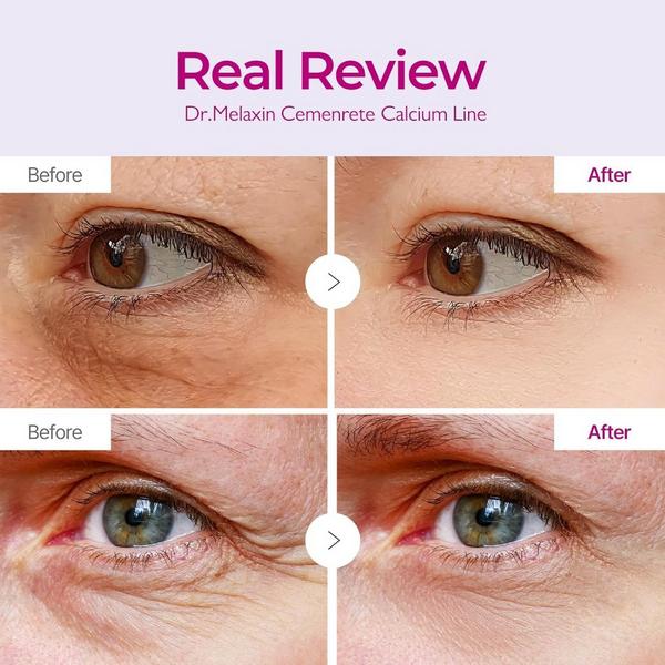Dr. Melaxin Calcium Volume Eye Patch #3