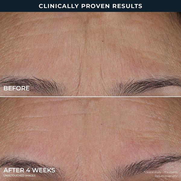 RoC Line Smoothing Triple Serum #6