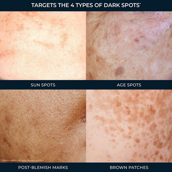 RoC Dark Spot Serum #7