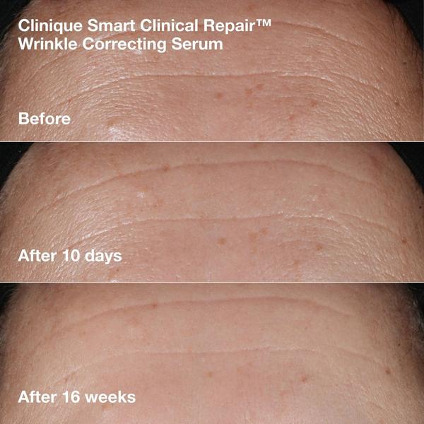Clinique 3 Piece Smart De-Aging Serum and Eye Cream Holiday Duo #5