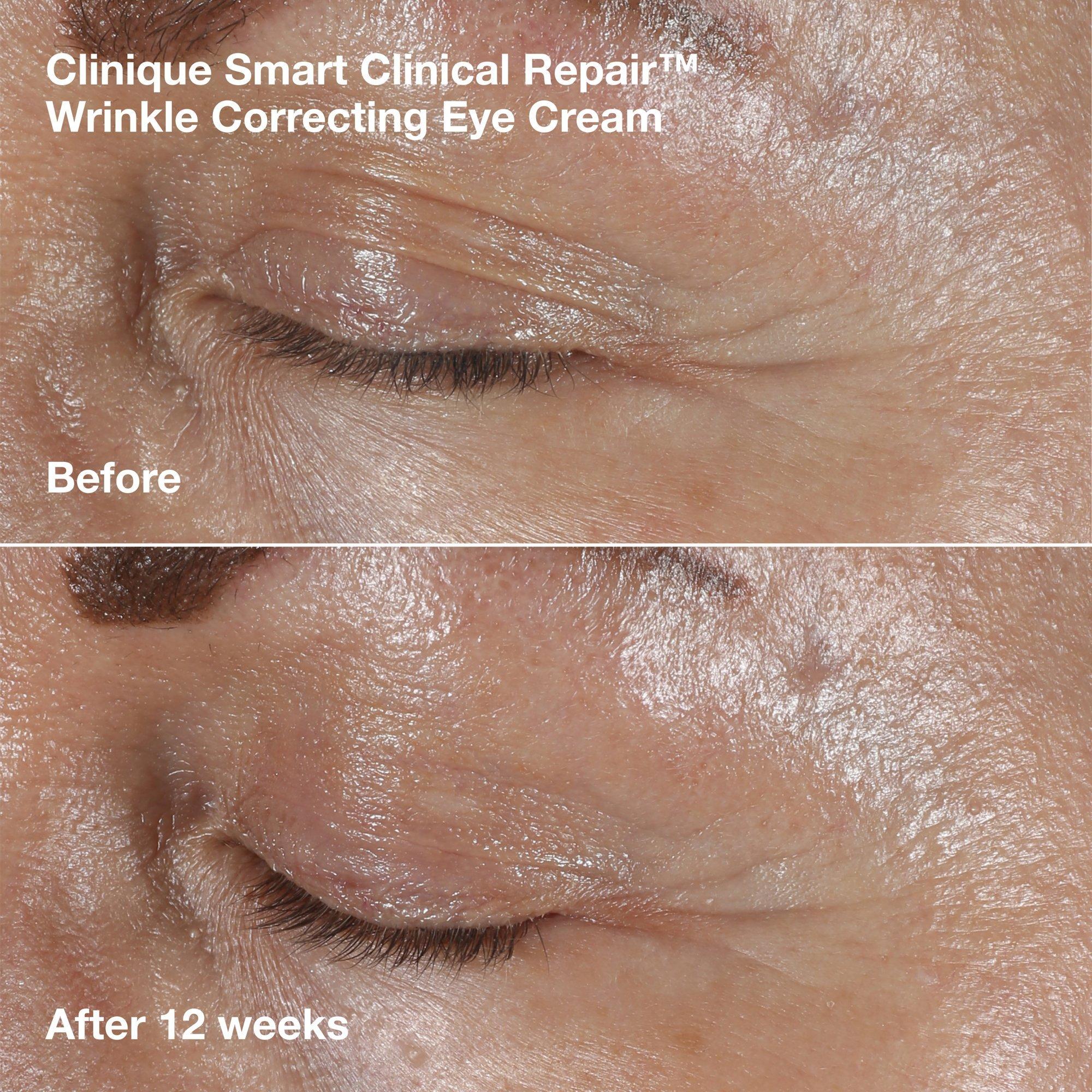 Подарочный набор Clinique Smart: омолаживающая сыворотка и крем для век, 3 предмета — фото 6