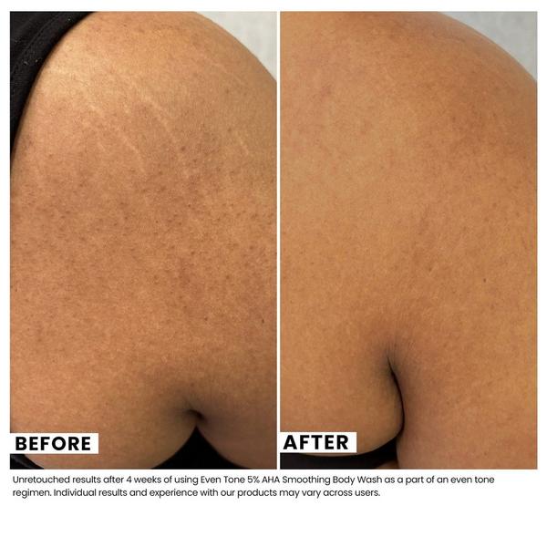 Urban Skin Rx Even Tone 5% AHA Smoothing Body Wash #3