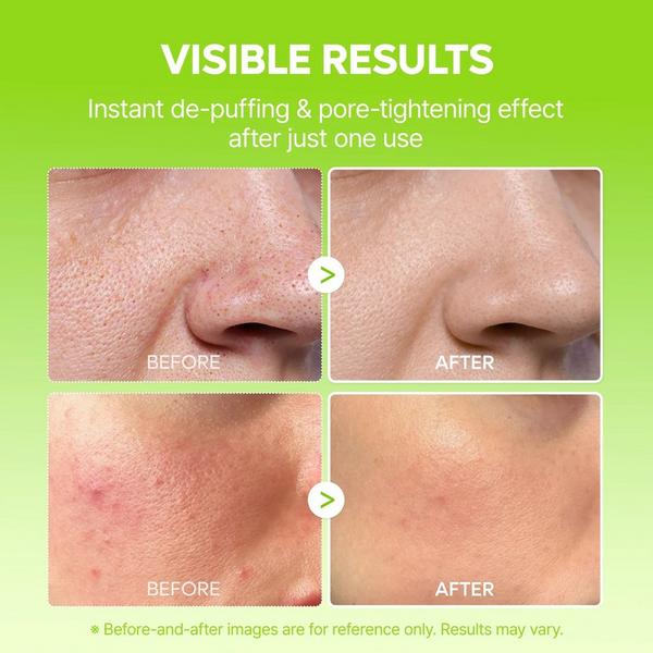 Dr. Melaxin CACTOX Pore Relief Jelly Serum Mist #4