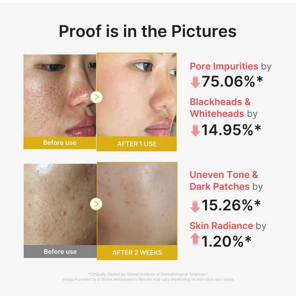 medicube Kojic Acid Turmeric Peel Shot #3
