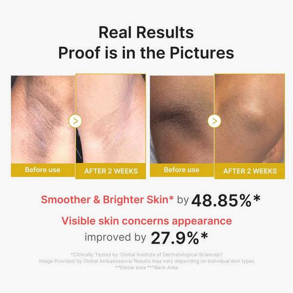 medicube Kojic Acid Turmeric Body Peel Shot #3