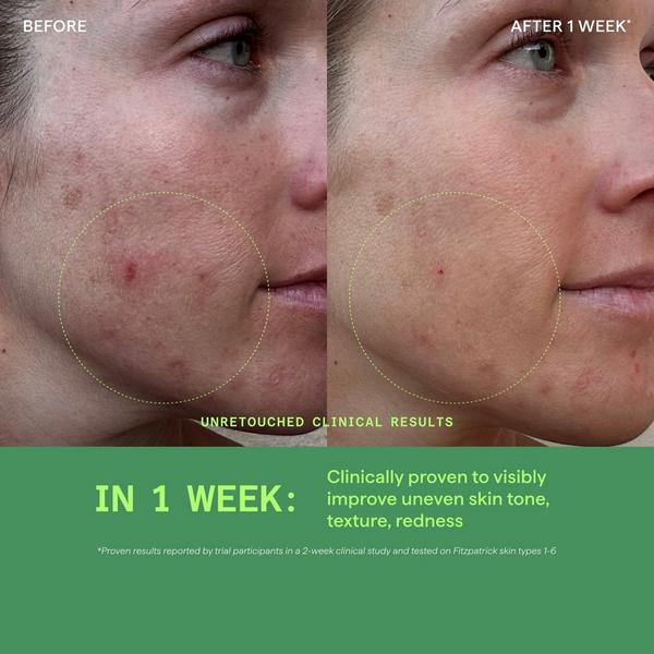 Murad Biome-Balancing Calm & Recover Cream #3