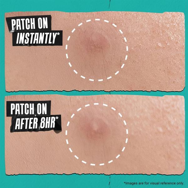 Kiehl's Since 1851 Truly Targeted Overnight Blemish Patch #4