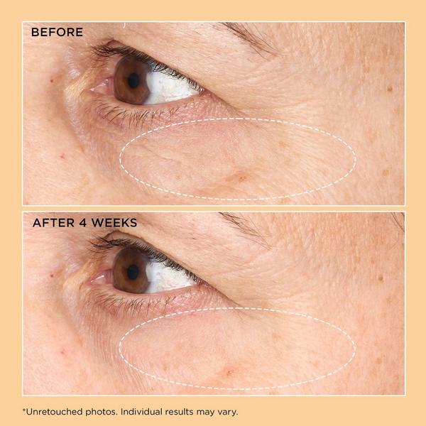 Perricone MD Neuropeptide Corrective Brightening Under-Eye Cream #3