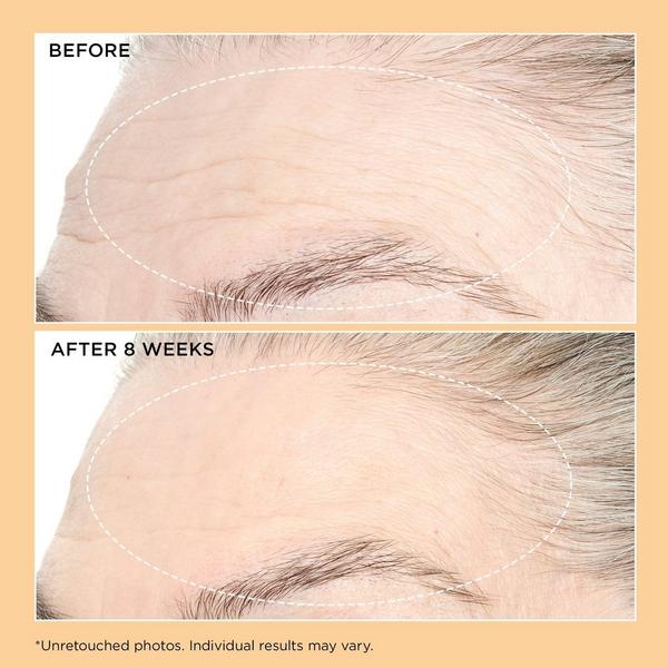 Perricone MD Neuropeptide Pro-Strength Moisturizer #3