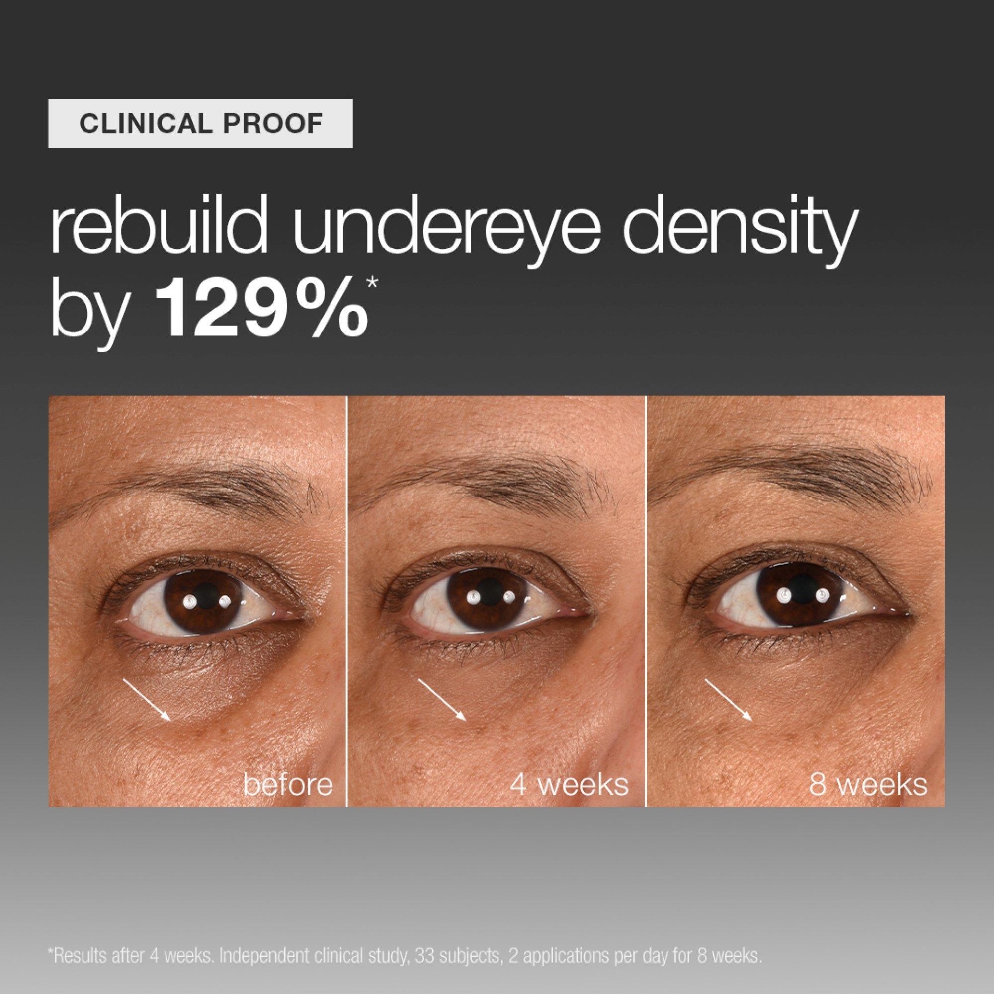 Уплотняющая сыворотка для кожи под глазами Dermalogica Smart Eye Density — фото 2