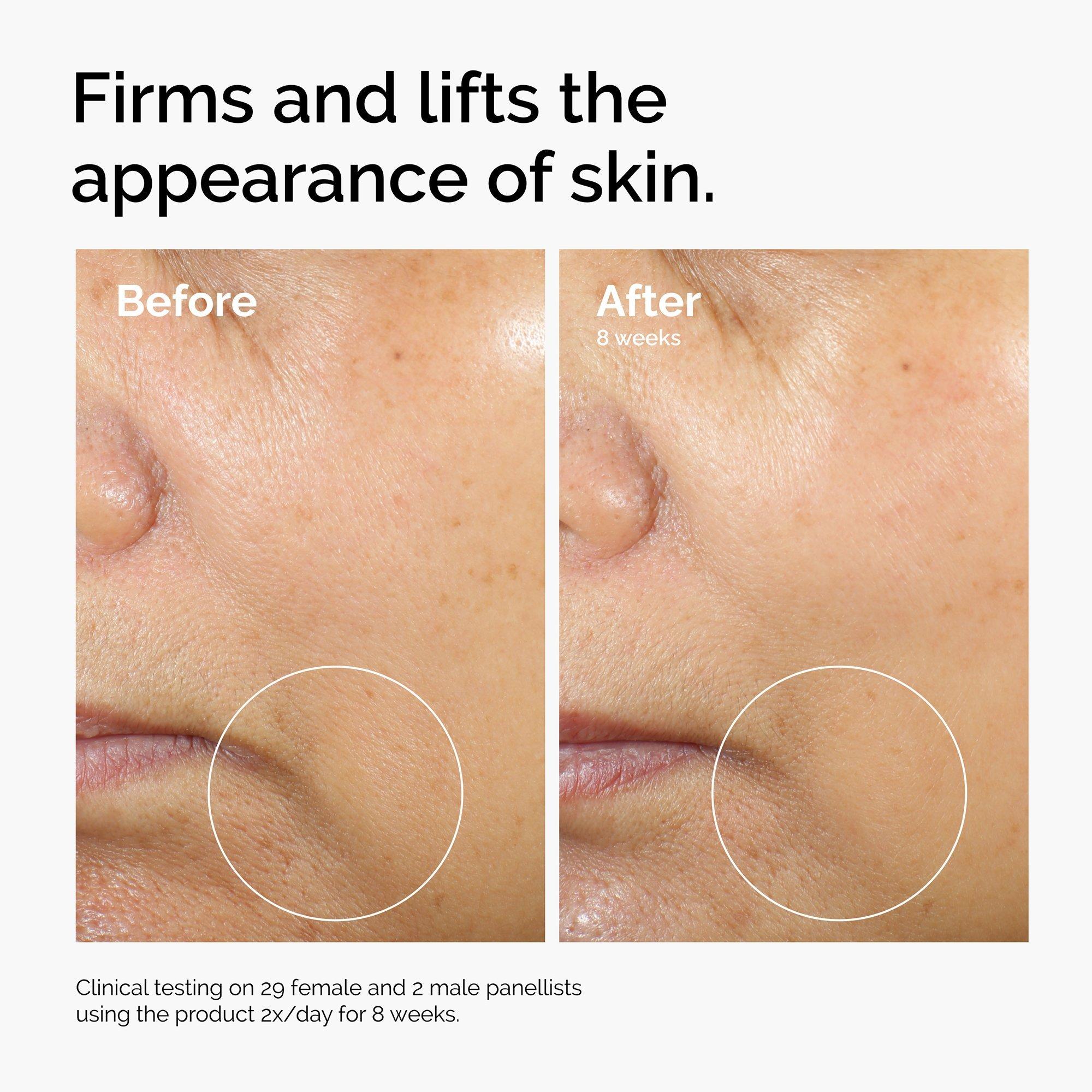 Сыворотка для лица The Ordinary с кофеином 3% и эсцином 1% — фото 3