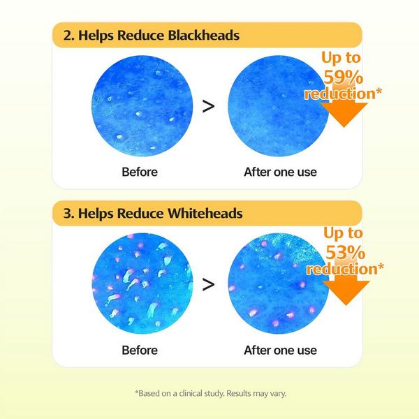 ClearDea. Green Tangerine Pore Tok-Tok Mask #6
