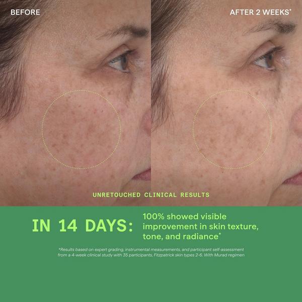 Murad Retinol Youth Renewal Serum #5