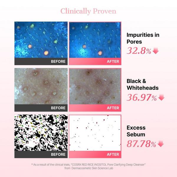 COSRX Red Rice Inositol Pore Clarifying Deep Cleanser #7