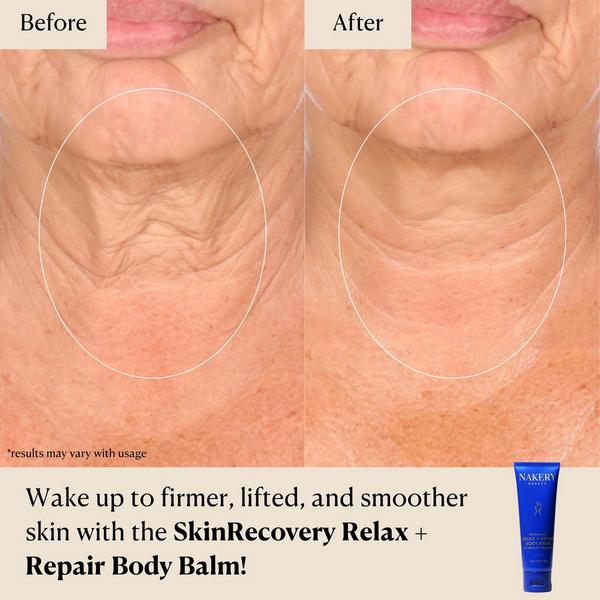 NAKERY BEAUTY SkinRecovery Relax + Repair Body Balm #3