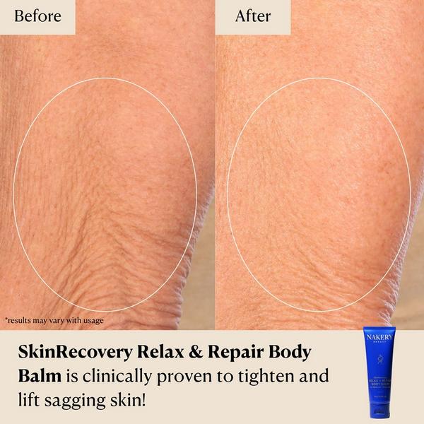 NAKERY BEAUTY SkinRecovery Relax + Repair Body Balm #4