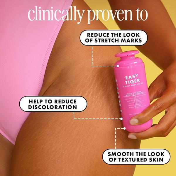 Truly Easy Tiger Stretch Mark Eraser #5