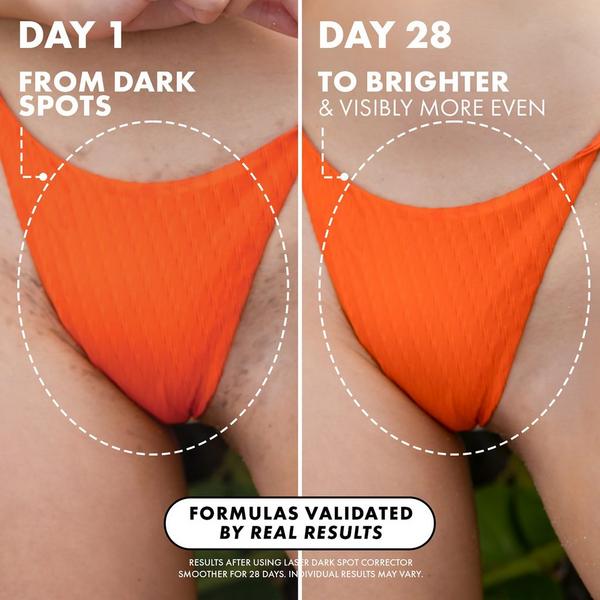 Truly Laser Spot Dark Spot Treatment #4