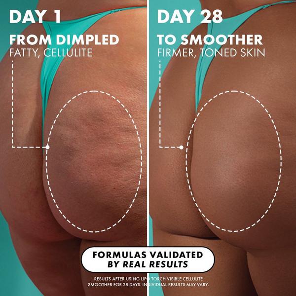 Truly Lipo Torch Cellulite Serum #4