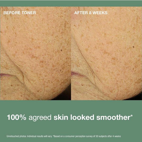StriVectin Multi-Action Clear Daily Brightening & Retexturizing Toner #5