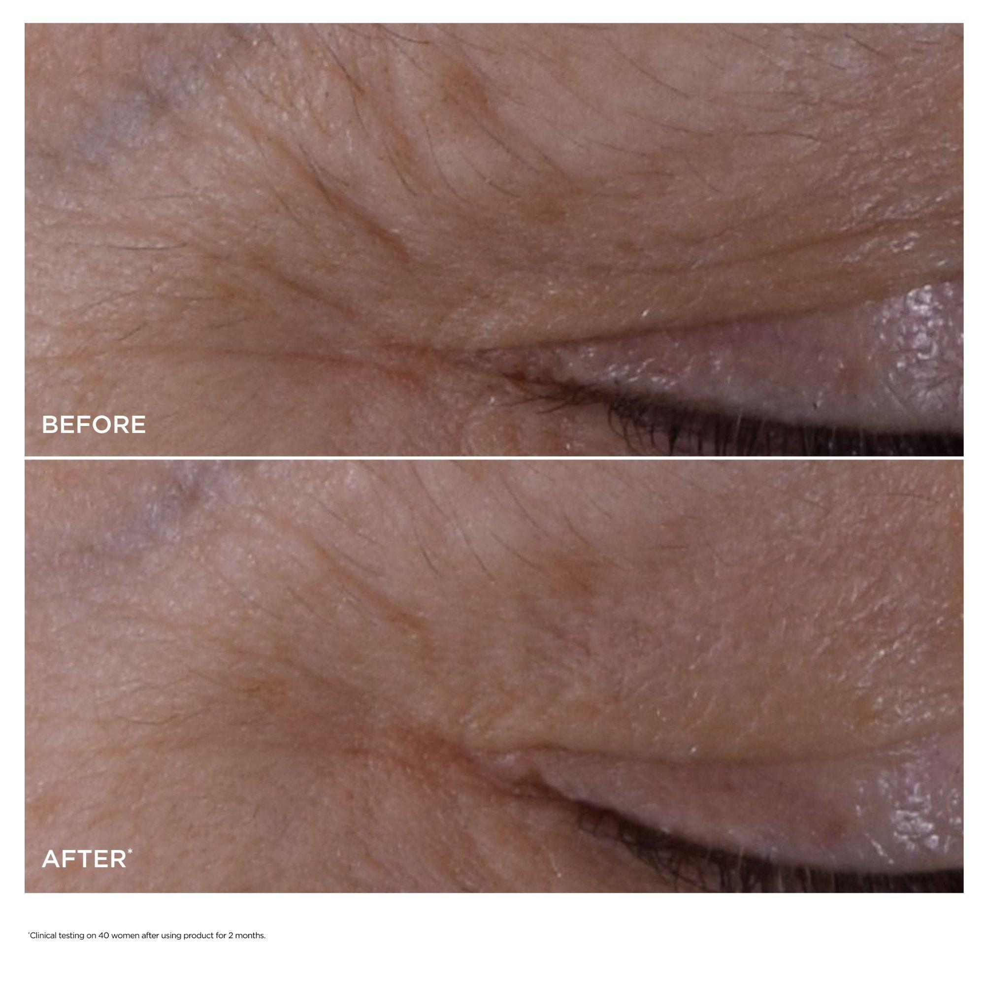 Антивозрастной концентрат для кожи вокруг глаз Clarins Double Serum — фото 4
