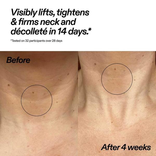 The INKEY List Bio-Active Ceramide Neck Lift Stick #3