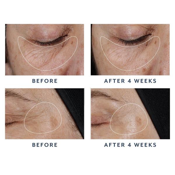 Bloomeffects Black Tulip RegeneLift Eye Serum #4