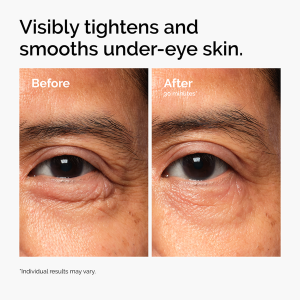 The Ordinary Lacto-PDRN 4% + B9 Eye Cream #3