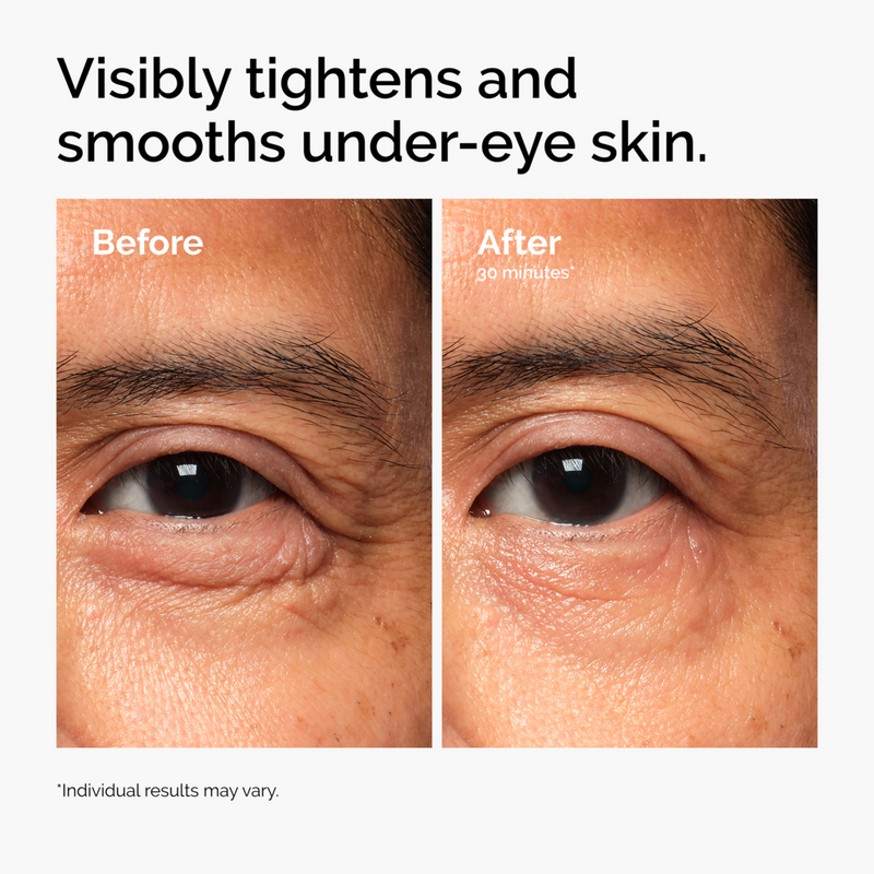 The Ordinary Lacto-PDRN 4% + B9 Eye Cream #3