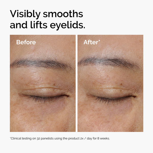 The Ordinary Lacto-PDRN 4% + B9 Eye Cream #5
