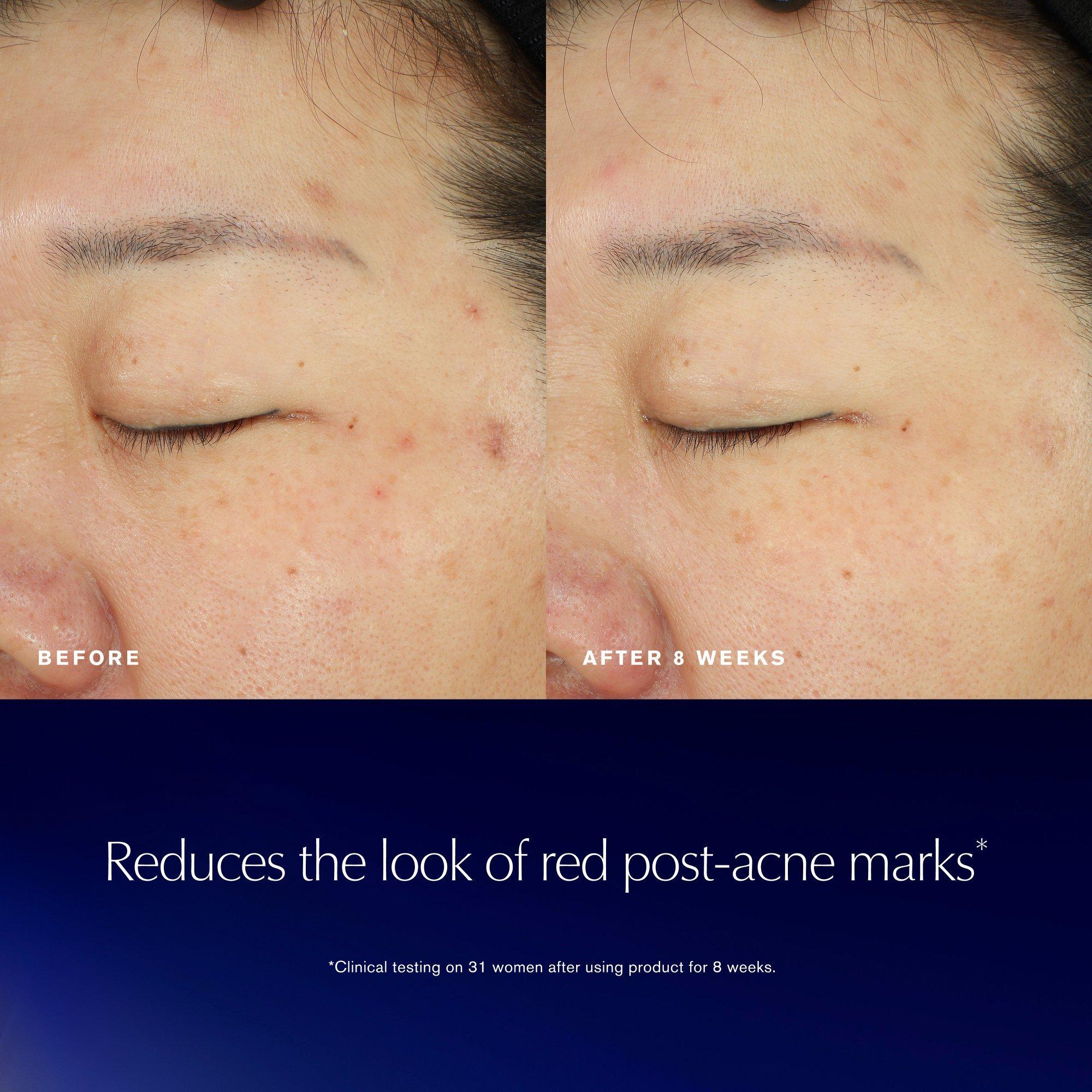 Восстанавливающая эссенция Estée Lauder Advanced Night Repair — фото 3
