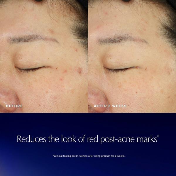 Estée Lauder Advanced Night Repair Recovery Treatment Essence #3