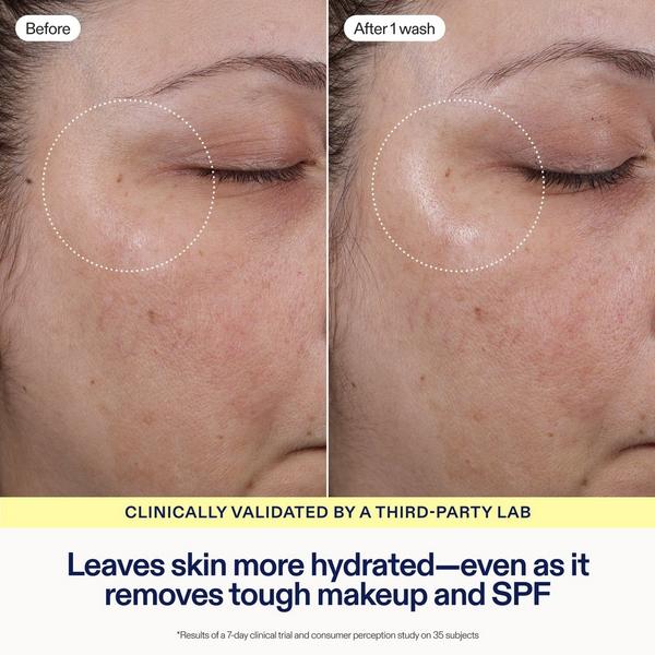 Skinfix Gentle Gel Ceramide + Ectoin Cleanser #4