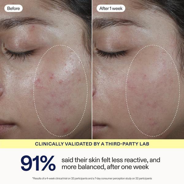Skinfix Barrier Balancing Water Cream #3
