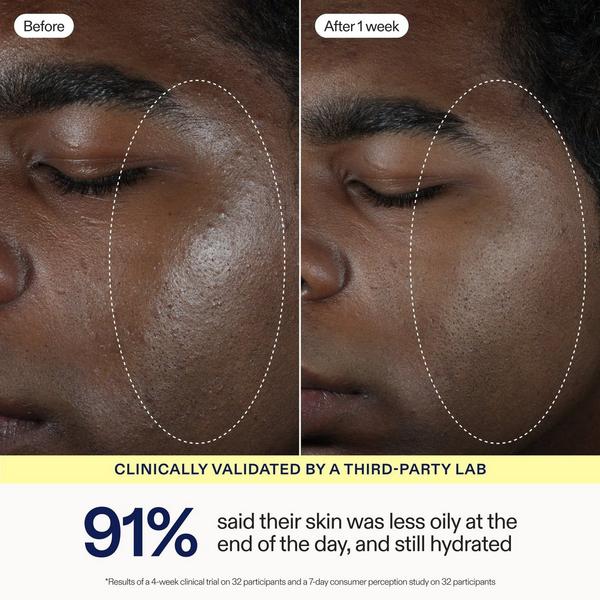 Skinfix Barrier Balancing Water Cream #4