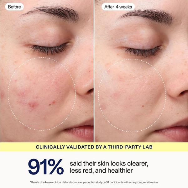 Skinfix Hypochlorous Daily Facial Mist #3