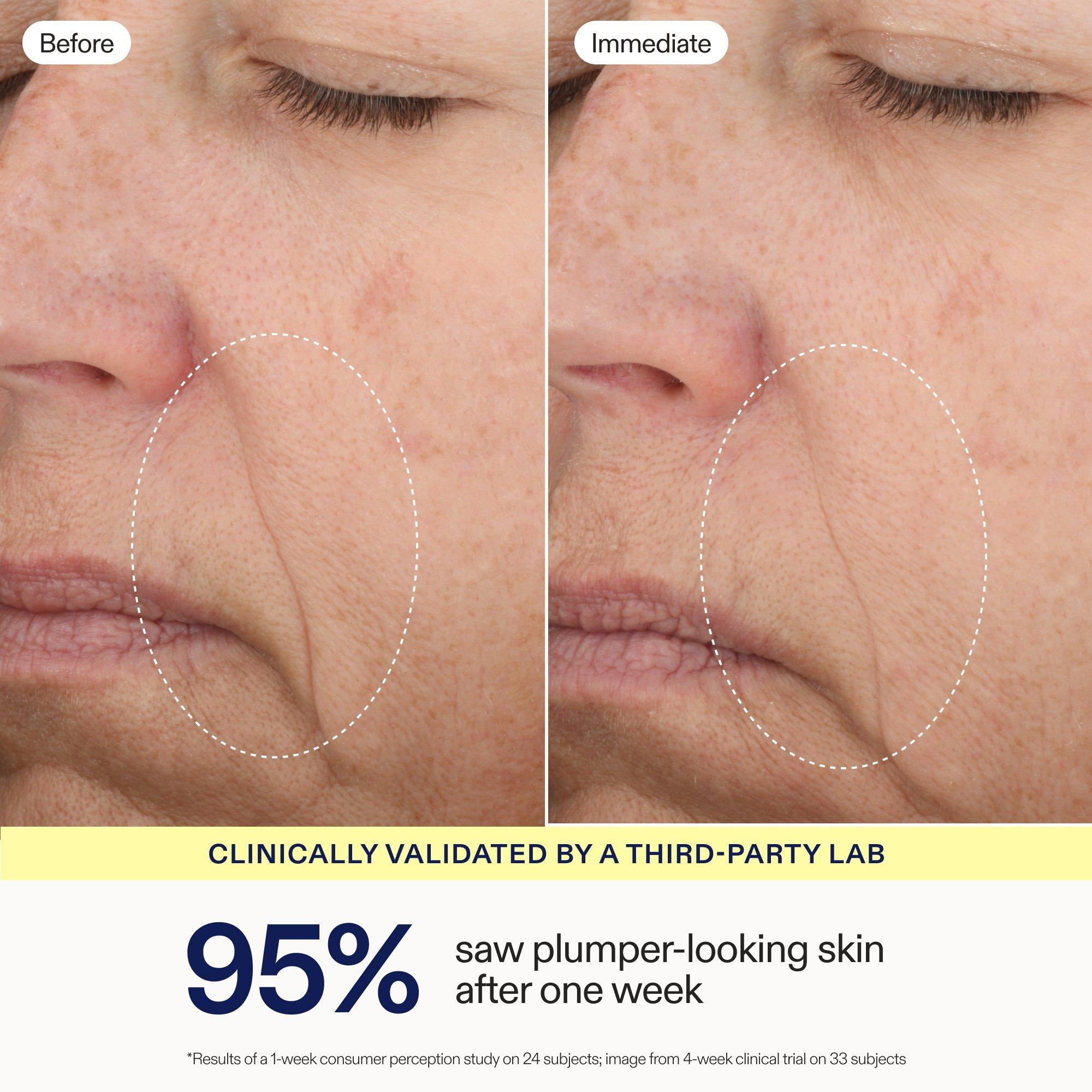 Активирующая сыворотка с тремя липидами Skinfix — фото 3