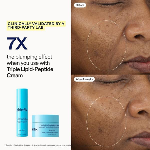Skinfix Starter Kit #5