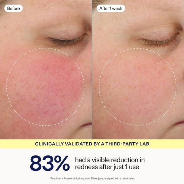 Skinfix Hydrating Foaming Oil Cleanser #3