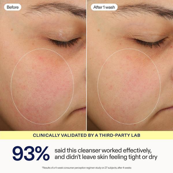 Skinfix Hydrating Foaming Oil Cleanser #4