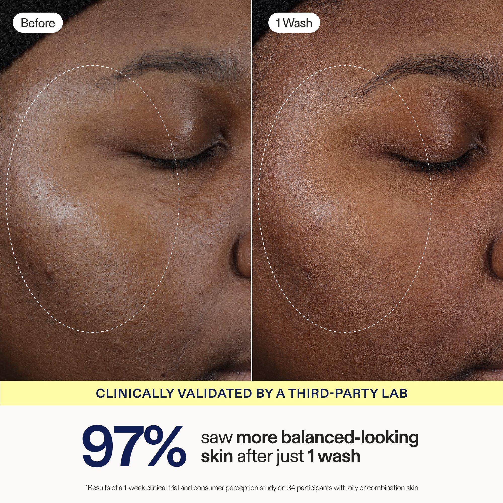 Балансирующее очищающее средство с глиной Skinfix в виде мягкой пенки — фото 4