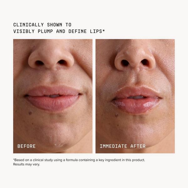 DRMTLGY Needle-less 4D Volumizing + Plumping Lip Treatment #7
