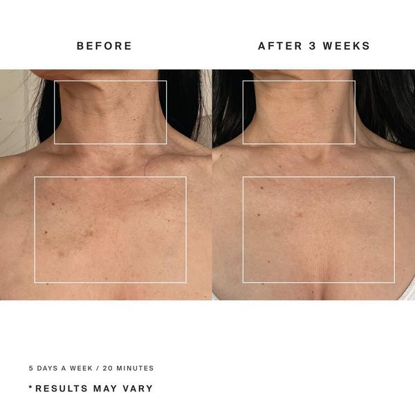 HigherDOSE Red Light Neck Enhancer #4