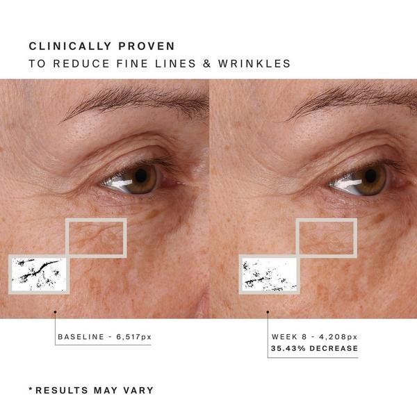 HigherDOSE Red Light Face Mask #4