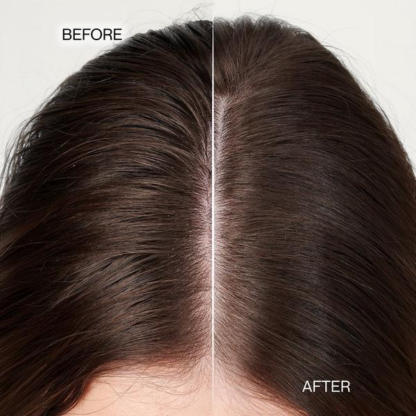 Nutrire S.1 Calm Shampoo for Dry Scalp #5