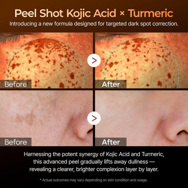 Dr. Melaxin Peel Shot Exfoliating Kojic Acid Turmeric Serum #3