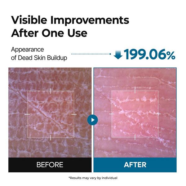Dr. Melaxin Peel Shot Exfoliating TX-Spray #3