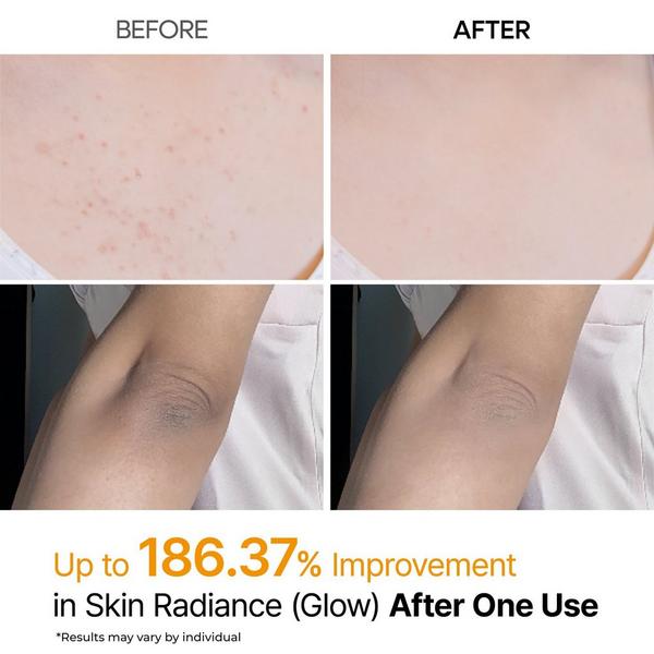 Dr. Melaxin Peel Shot Exfoliating Kojic Acid Turmeric Spray #3