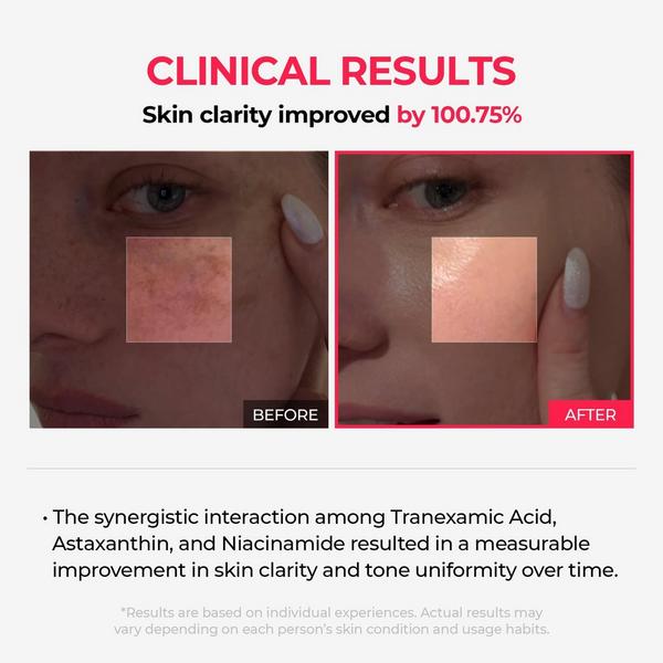 Dr. Melaxin TX-Astaxanthin Overnight Wrapping Mask #2